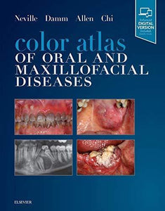 Color Atlas Of Oral And Maxillofacial Diseases.